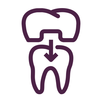 veneers